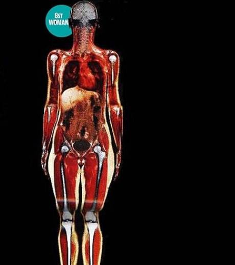 image50k The abuse omega 6 and the deficit in omega 3 support obesity from generation to generation